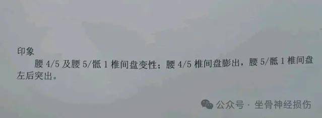 揭秘坐骨神经痛的多样“痛点”